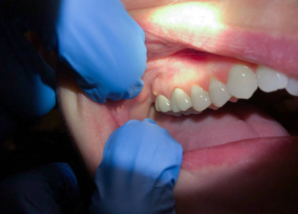 Dentist for Dental Trauma in TX